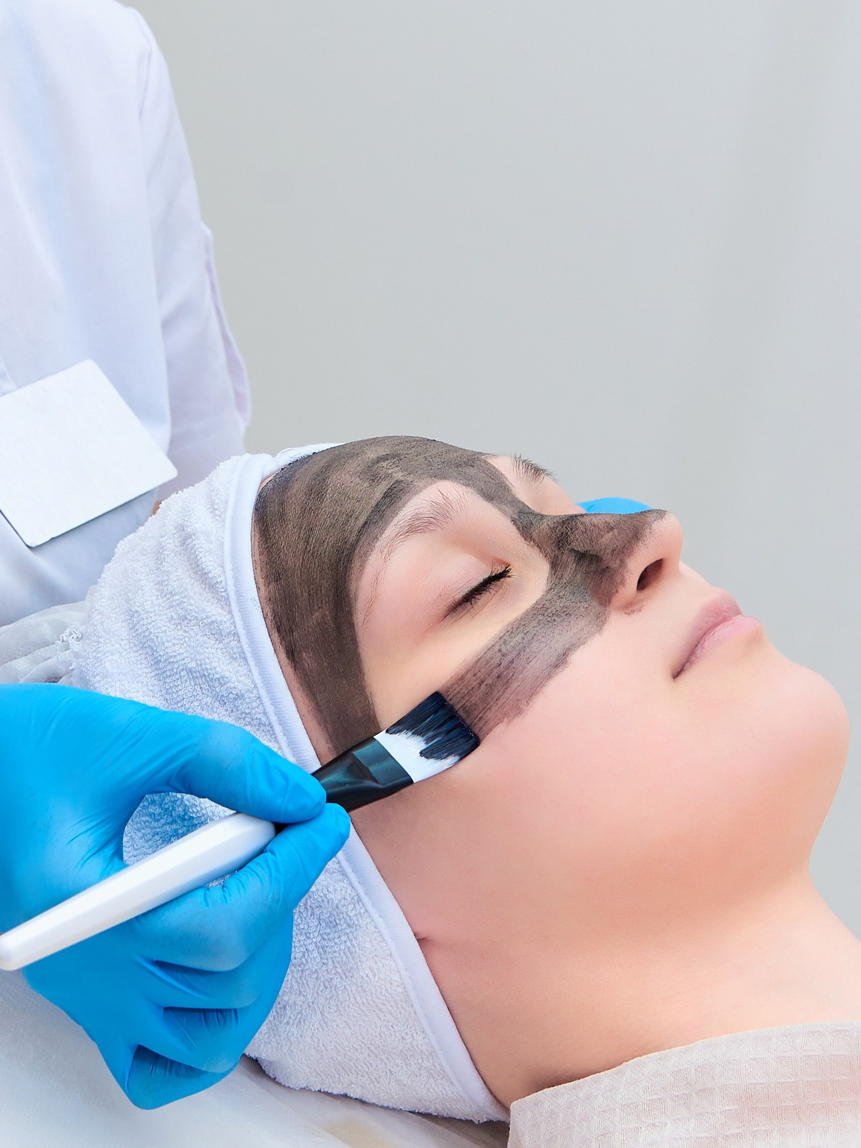 Procedure carbon facial peeling in the clinic of laser cosmetology.
